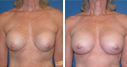 Before & After Photos